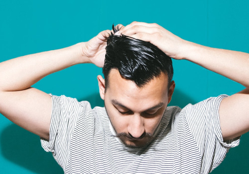 Understanding Medical Treatments for Male Pattern Baldness