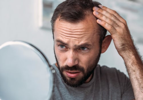 Thyroid Disorders and Hair Loss: Understanding the Connection